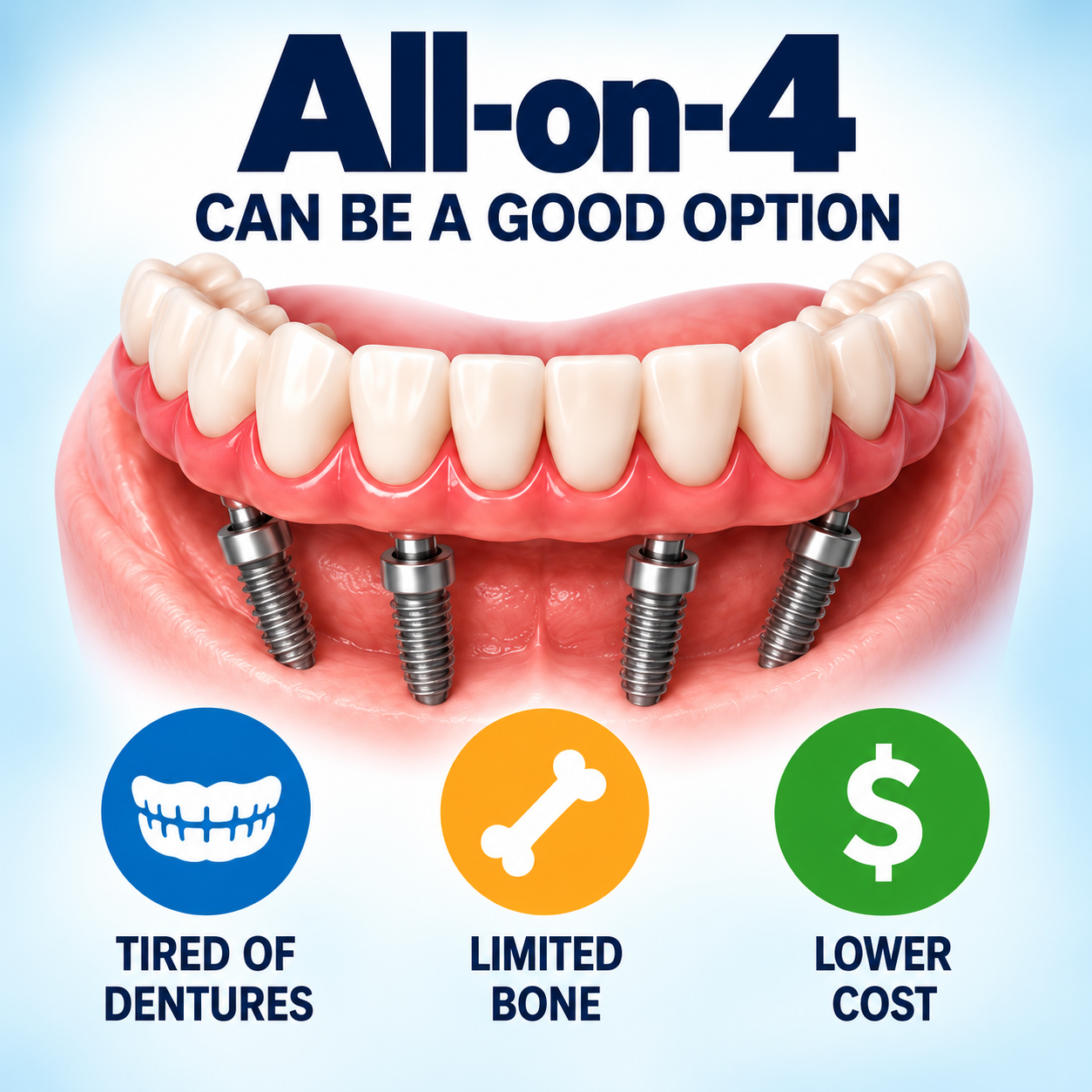 All-on-4 dental implants infographic
