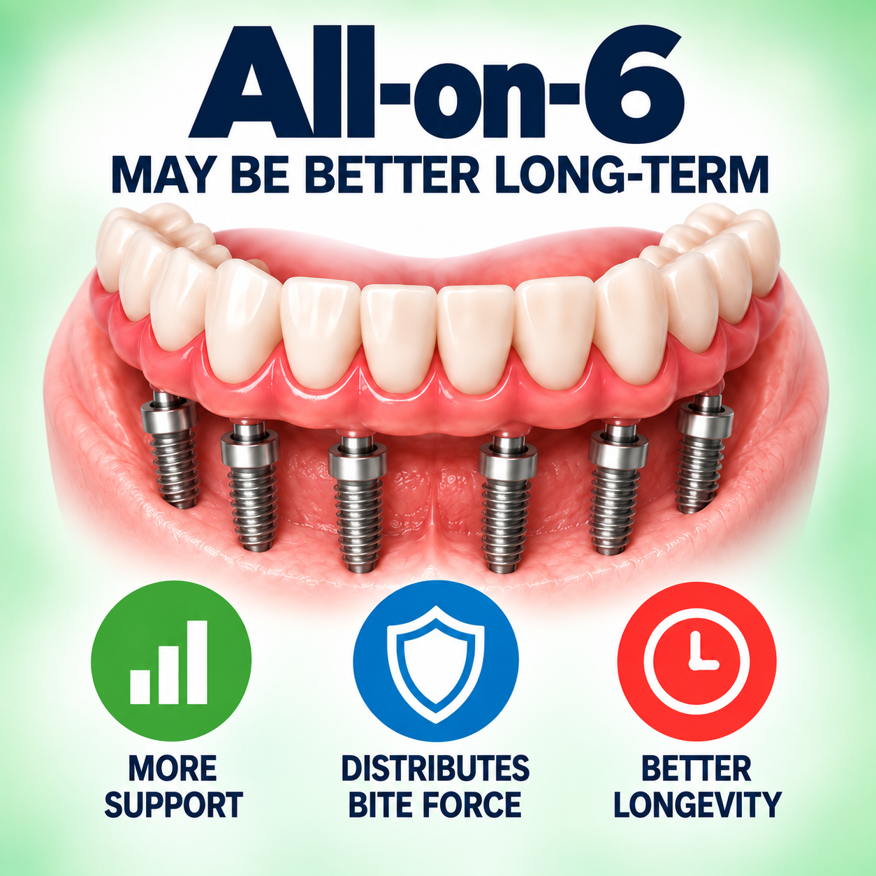 All-on-6 dental implants infographic