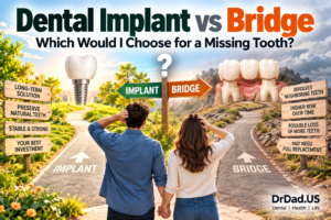 Dental implant vs bridge decision for replacing a missing tooth