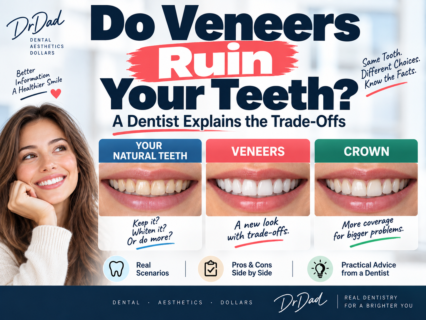 Do Veneers Ruin Your Teeth? A Dentist Explains the Trade-Offs – A Practicing Dentist Explains