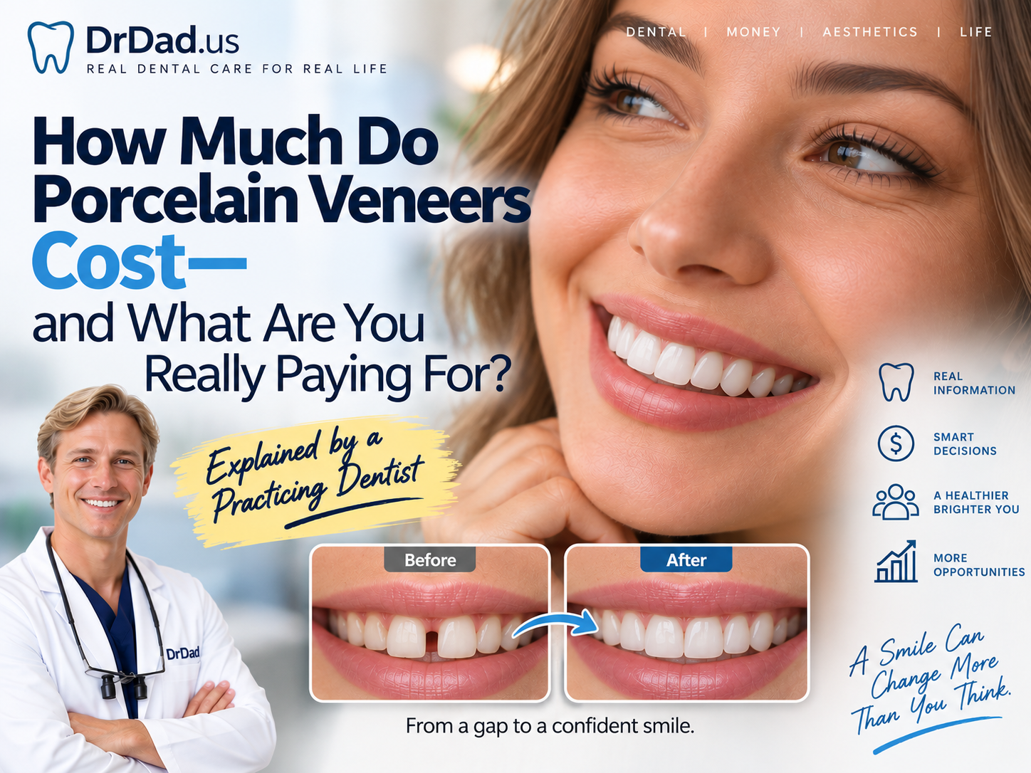 How Much Do Porcelain Veneers Cost—and What Are You Really Paying For? – A Practicing Dentist Explains