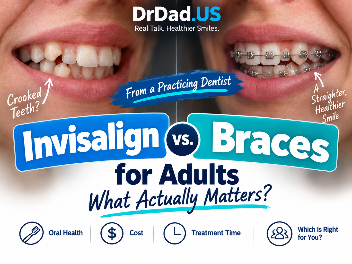 Invisalign vs Braces for Adults: What Actually Matters? – A Practicing Dentist Explains