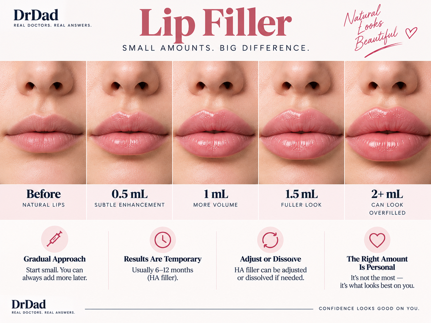 Lip filler amount comparison showing gradual volume changes from 0.5 mL to 2+ mL