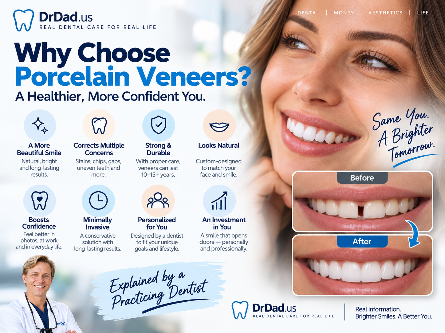 Porcelain veneers infographic explaining benefits and considerations, by DrDad.us.