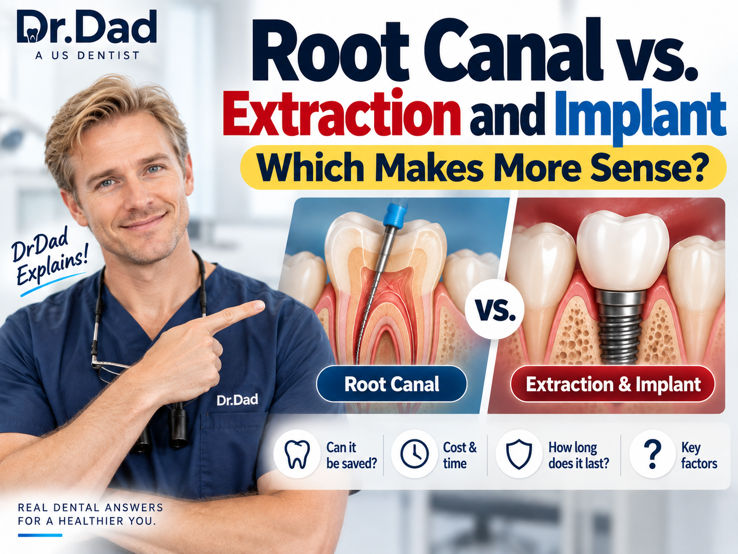 Root Canal vs. Extraction and Implant: Which Makes More Sense? – A Practicing Dentist Explains