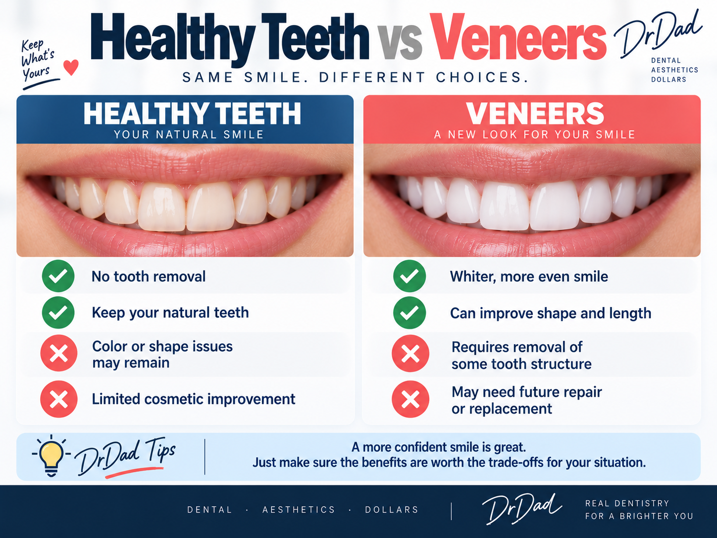 Healthy teeth versus veneers comparison