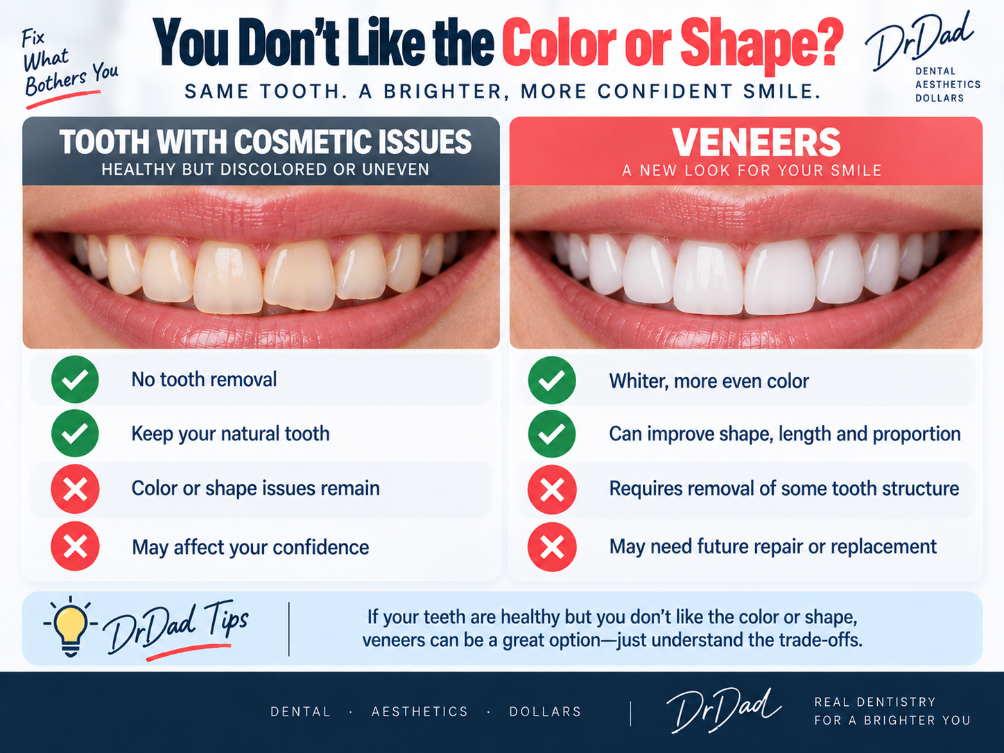 Cosmetically compromised healthy teeth versus veneers