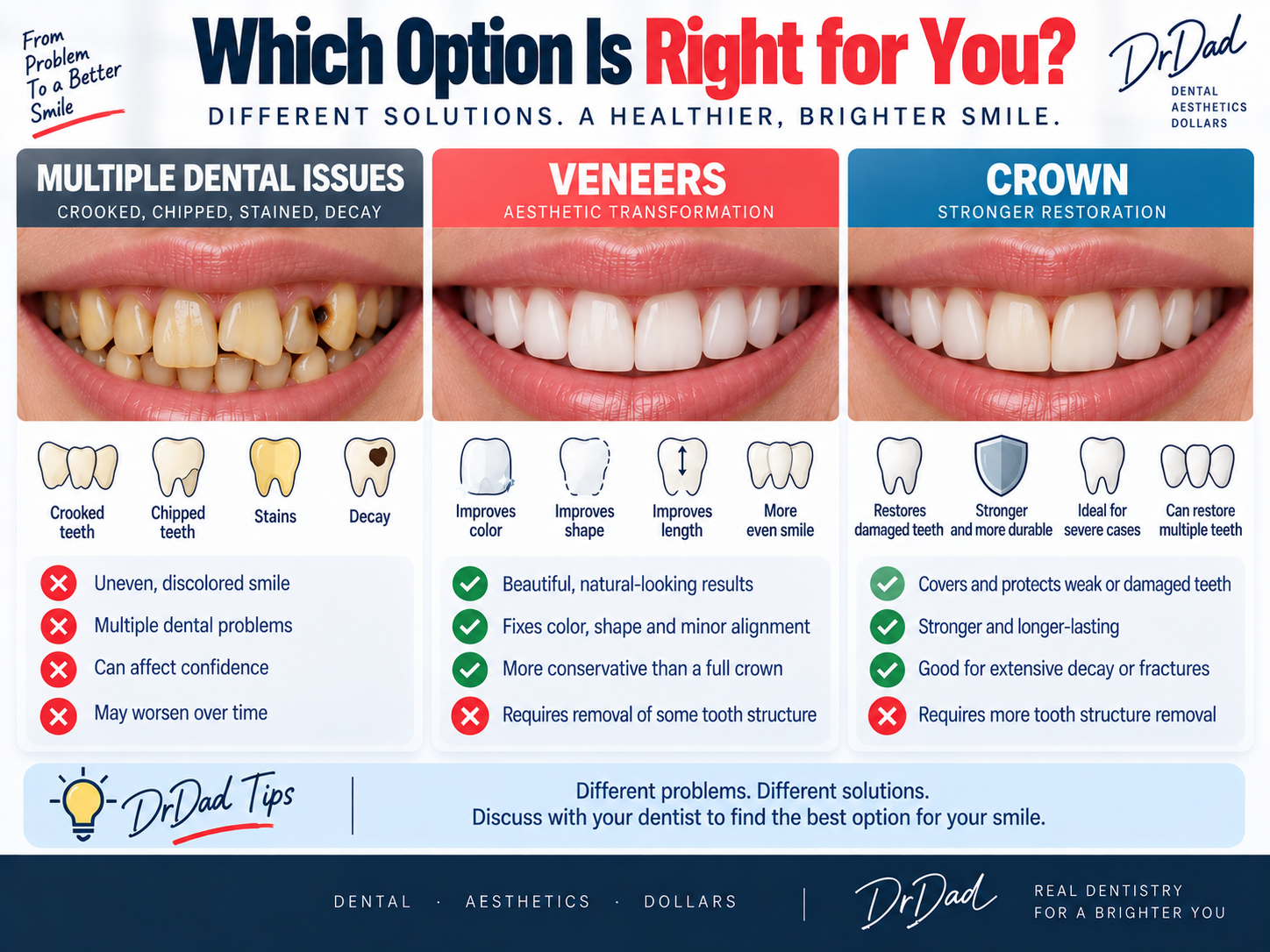 Multiple dental problems compared with veneers and crowns