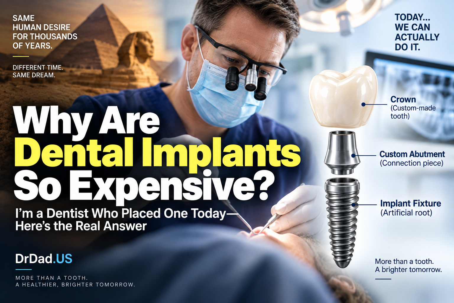 Why Are Dental Implants So Expensive? I’m a Dentist Who Placed One Today—Here’s the Real Answer – A Practicing Dentist Explains
