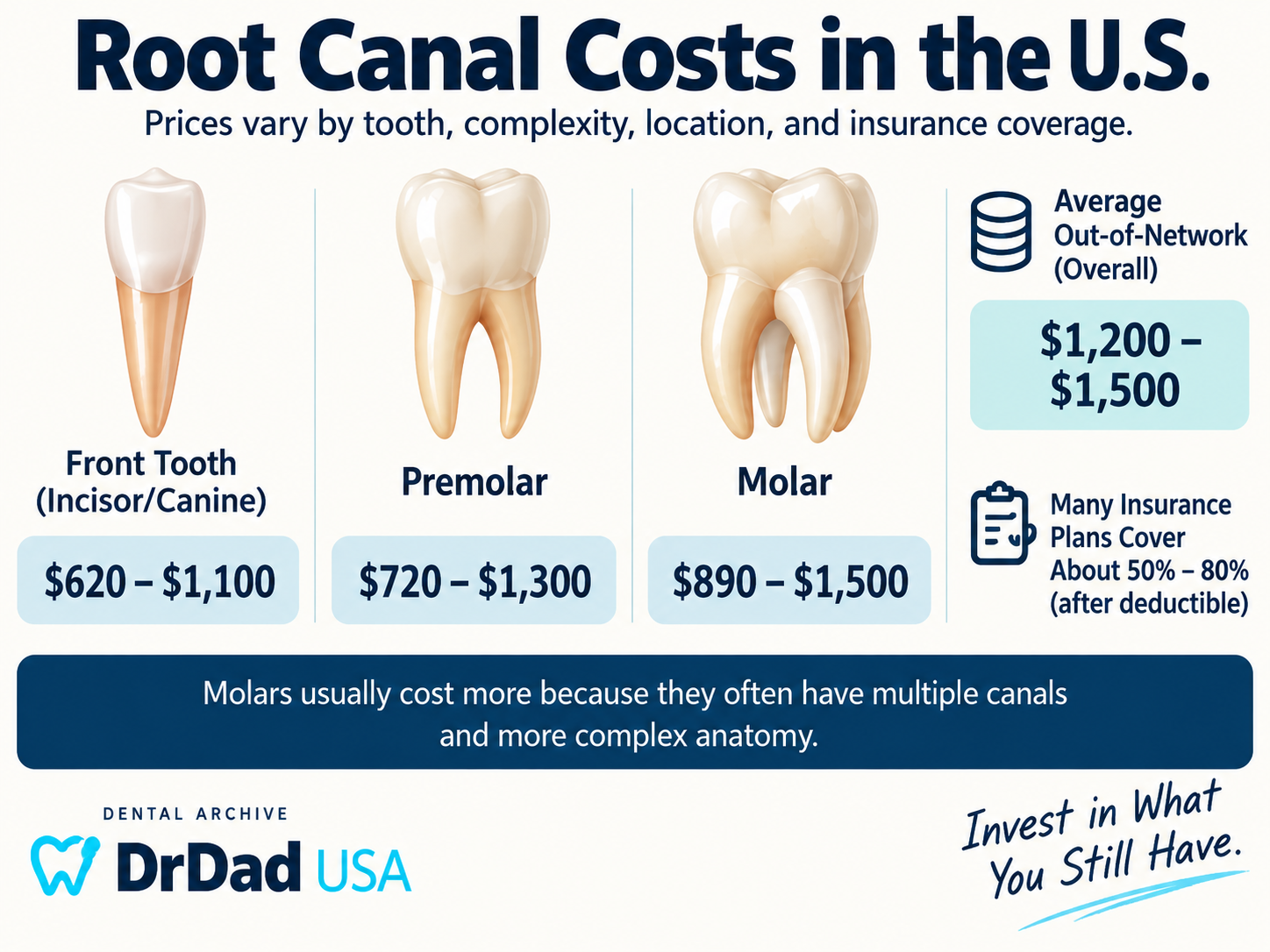 Root canal costs in the U.S. by tooth type