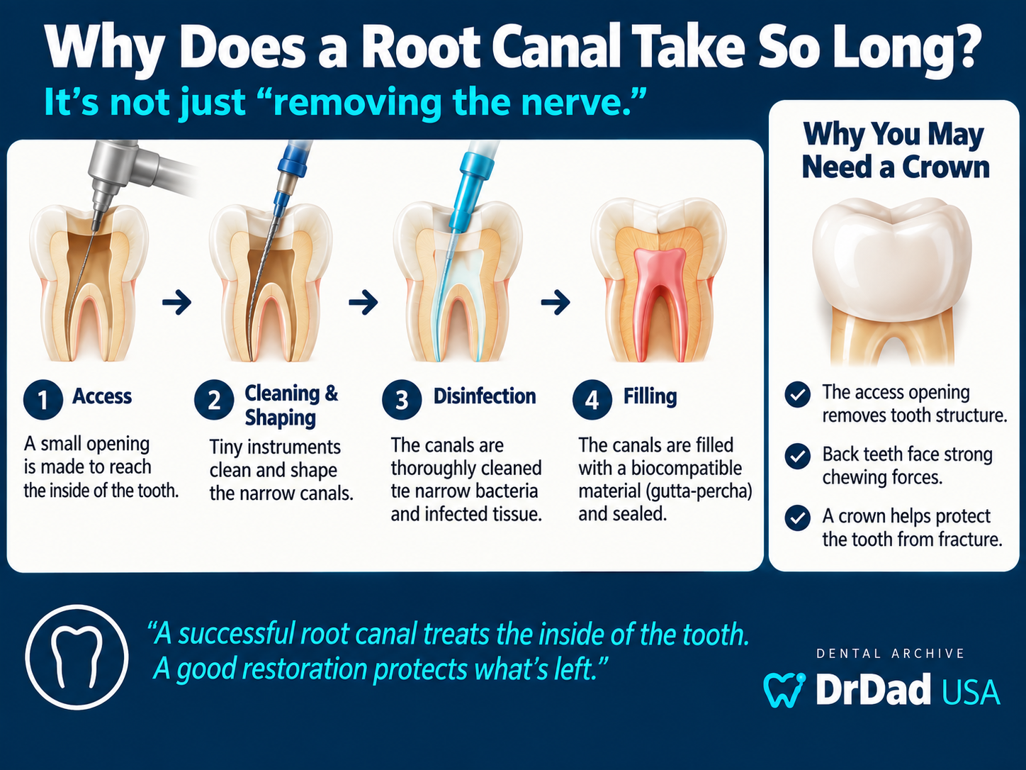 Root canal treatment steps and crown protection