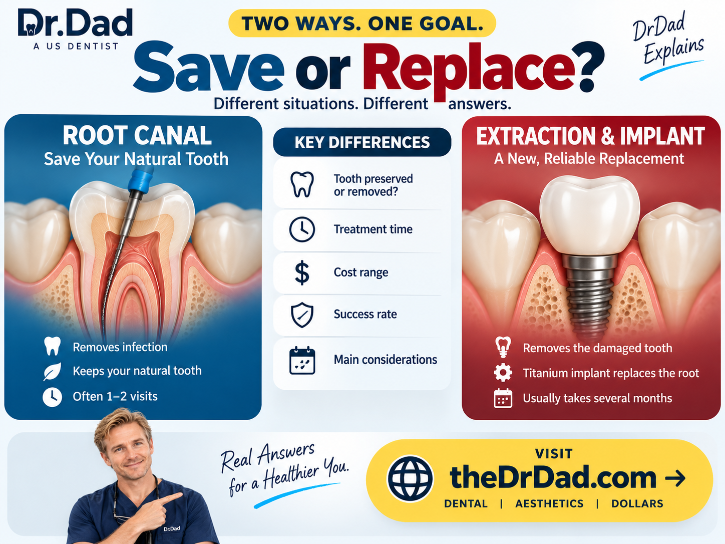 Root canal versus extraction and implant overview