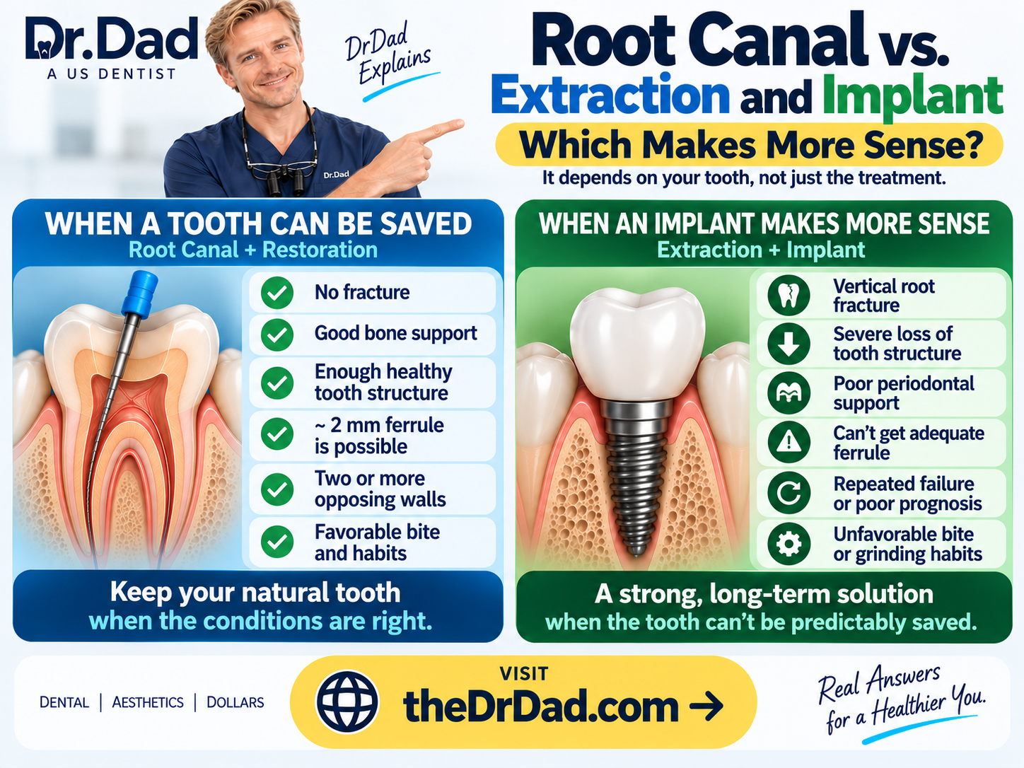 Conditions for saving a tooth versus choosing extraction and implant